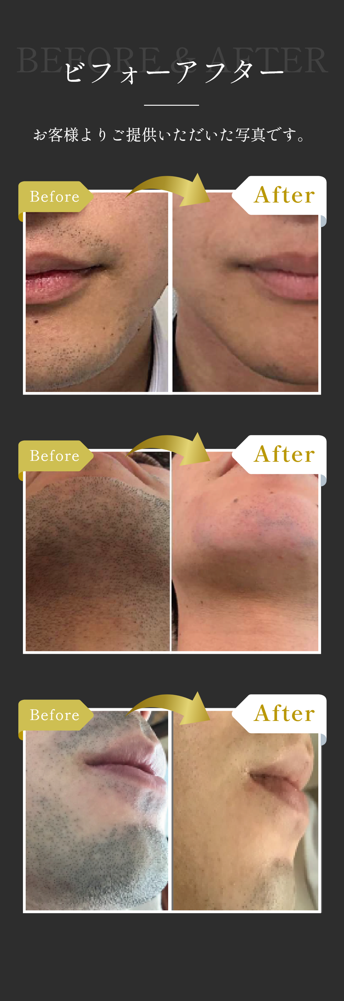 ビフォーアフター